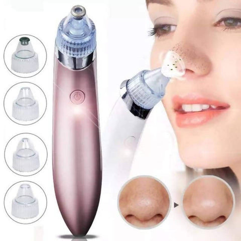 Blackhead Vacuum Removal - Whitehead Extractor-Pimple Pore Cleaner Vacuum Suction Tool (4 in 1) - MarkeetEx